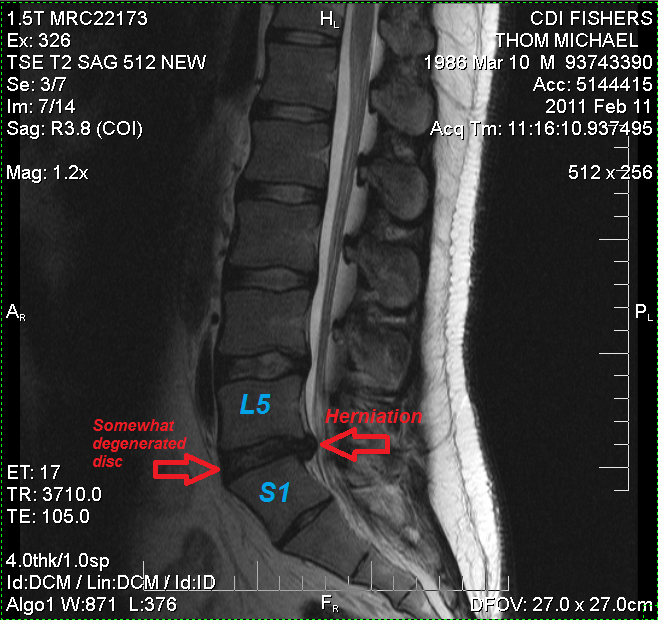 discMRI